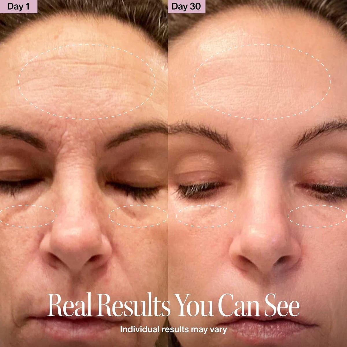 Survora® Halo - 4-in-1 Skincare Wand