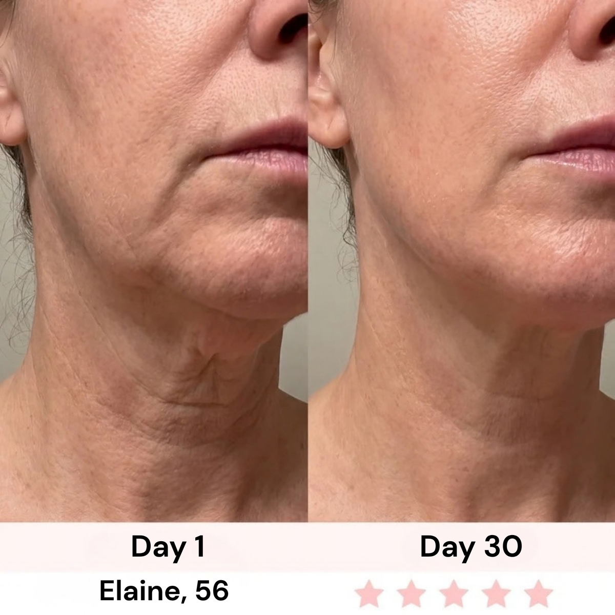 Survora® Halo - Jawline Lifting Wand