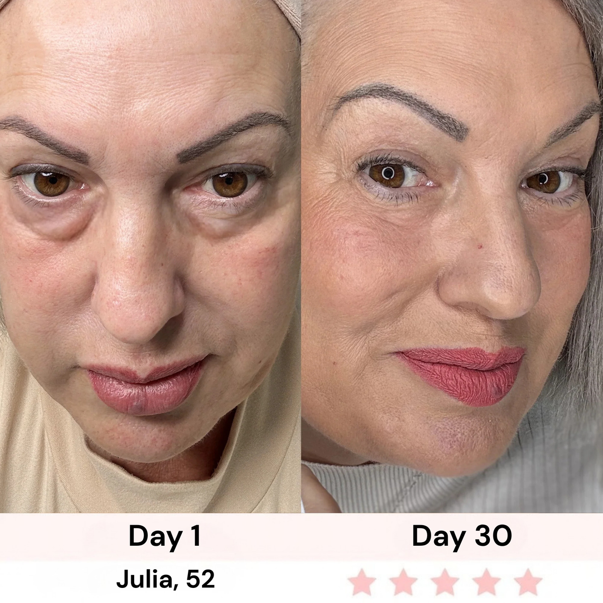 Survora® Halo - Eye Lift Wand