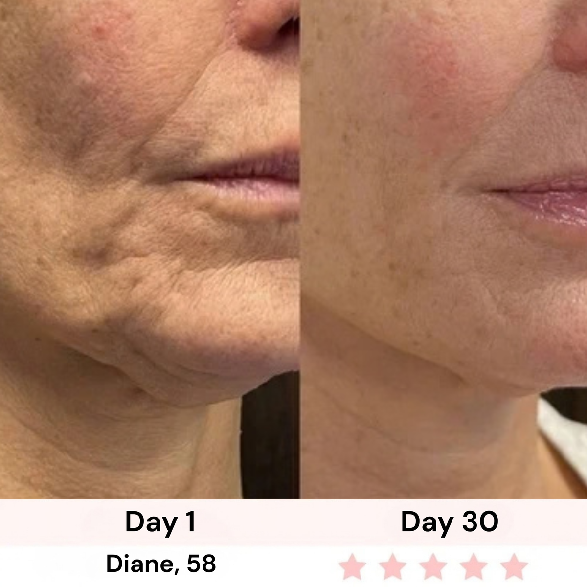 Survora® Halo - Jawline Lifting Wand