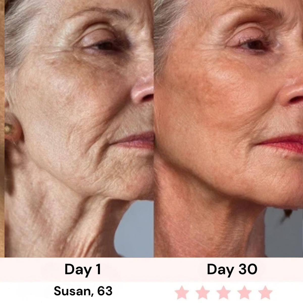 Survora® Halo - Jawline Lifting Wand