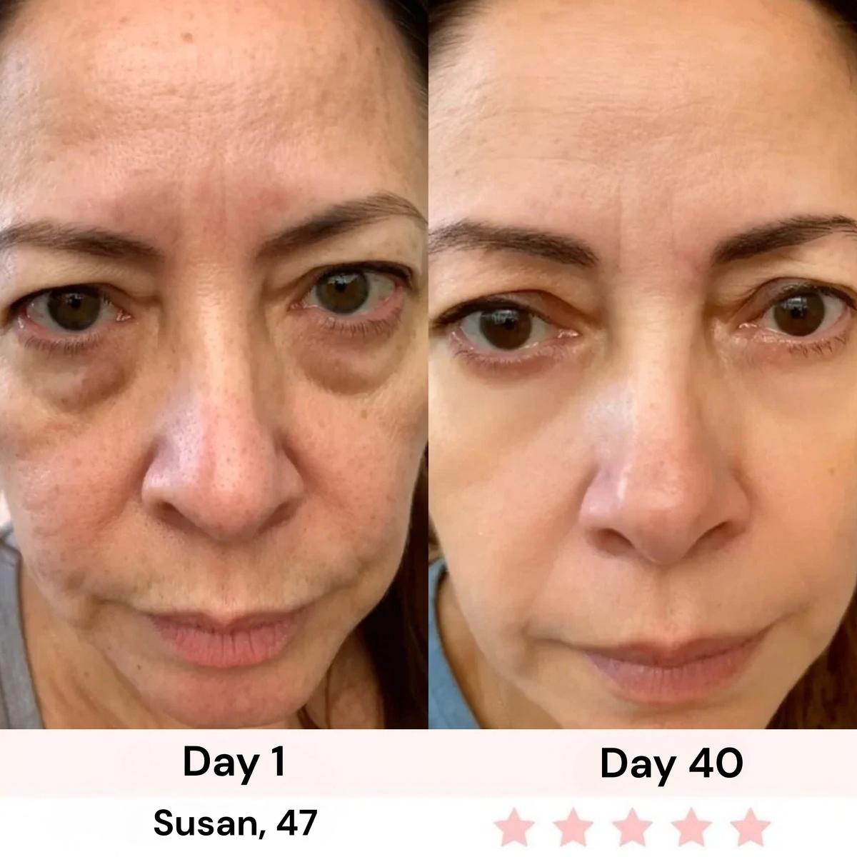 Survora® Halo - Eye Lift Wand
